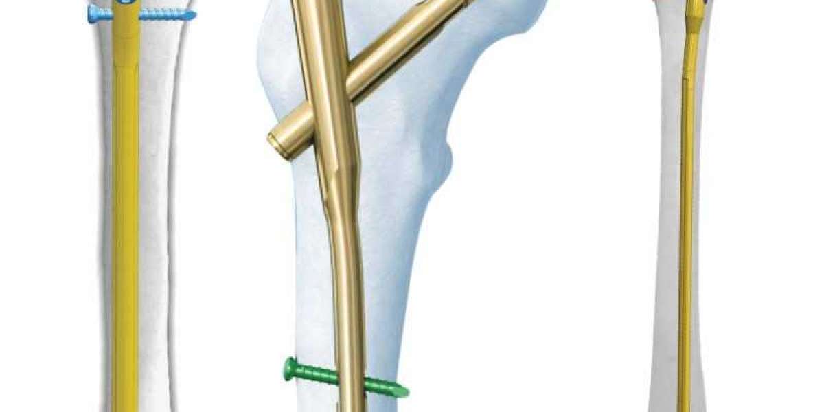 Experienced Orthopedic Device Manufacturers