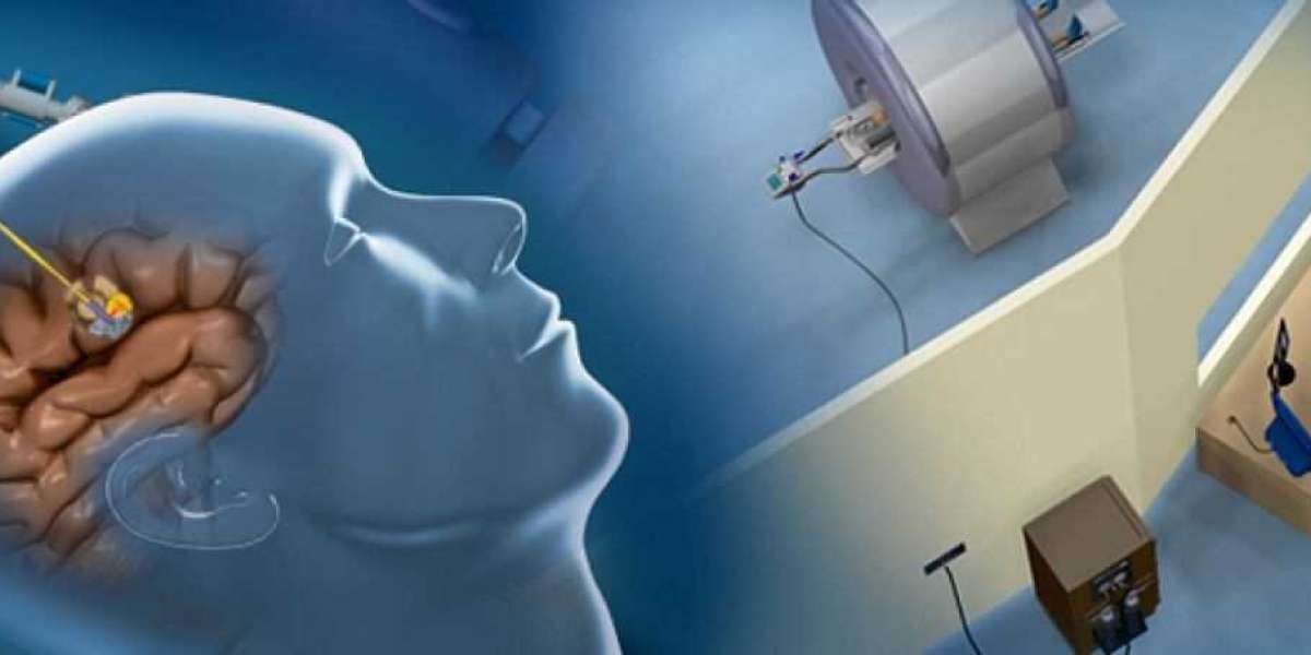 According to Epilepsy Surgery Market Report, There is a Massive Growth