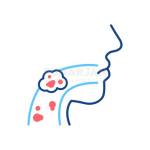 Oral Cancer Profile Picture