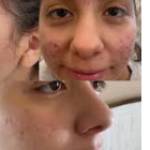Skin denver Profile Picture